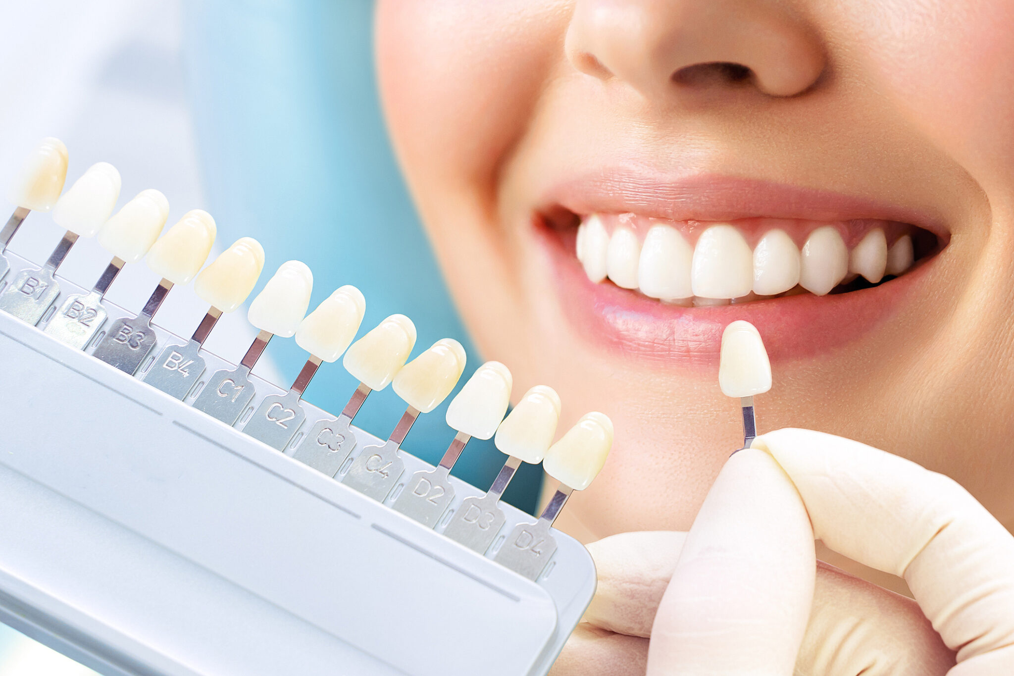 porto-odontologia-tratamentos-facetas
